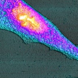 Human embryo fibroblast