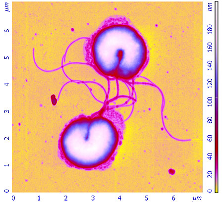 helicobacter_pylori